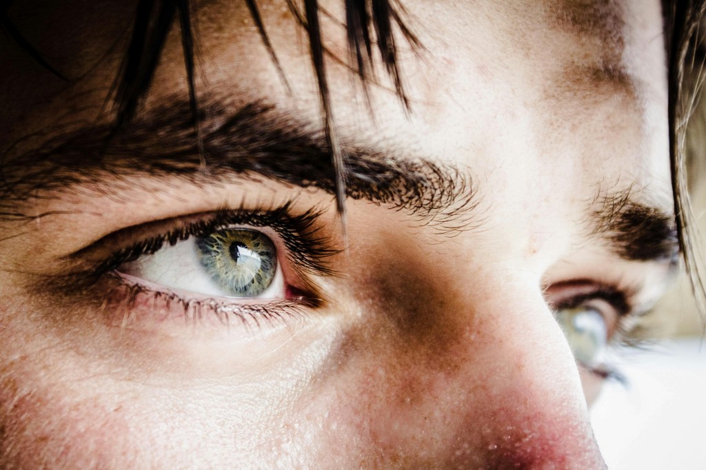 What is “Dry Eye Syndrome”?